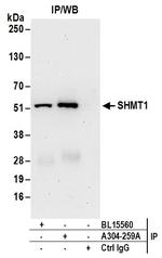 SHMT1 Antibody in Immunoprecipitation (IP)