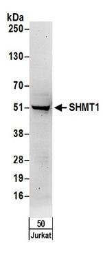 SHMT1 Antibody in Western Blot (WB)