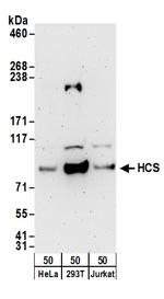 HCS Polyclonal Antibody