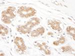 RPN2 Antibody in Immunohistochemistry (Paraffin) (IHC (P))