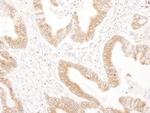 RPN2 Antibody in Immunohistochemistry (Paraffin) (IHC (P))