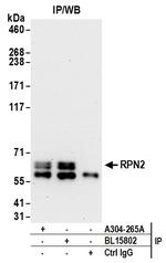 RPN2 Antibody in Immunoprecipitation (IP)