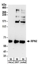 RPN2 Antibody in Western Blot (WB)