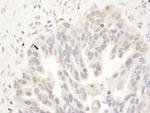 DCK Polyclonal Antibody