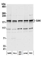 GAK Polyclonal Antibody
