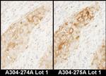 WARS Polyclonal Antibody