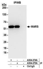 WARS Antibody in Immunoprecipitation (IP)
