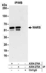 WARS Antibody in Immunoprecipitation (IP)