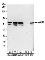 WARS Antibody in Western Blot (WB)