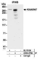 KIAA0947 Antibody in Immunoprecipitation (IP)