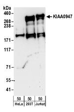 KIAA0947 Polyclonal Antibody