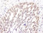 DNMT3A Polyclonal Antibody