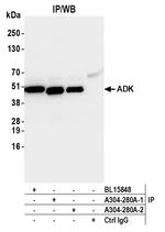 ADK Antibody in Immunoprecipitation (IP)