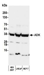 ADK Antibody in Western Blot (WB)