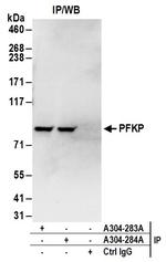 PFKP Antibody in Immunoprecipitation (IP)