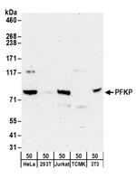PFKP Polyclonal Antibody