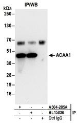 ACAA1 Antibody in Immunoprecipitation (IP)