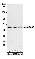 ACAA1 Polyclonal Antibody
