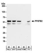 PFKFB2 Polyclonal Antibody