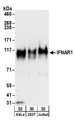 IFNAR1 Polyclonal Antibody