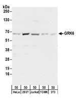 GRK6 Polyclonal Antibody