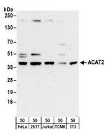 ACAT2 Antibody in Western Blot (WB)