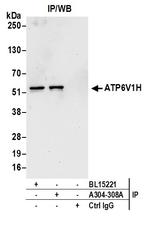ATP6V1H Antibody in Immunoprecipitation (IP)