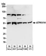 ATP6V1H Polyclonal Antibody