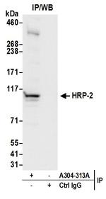 HRP-2 Polyclonal Antibody