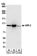 HRP-2 Polyclonal Antibody