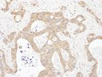 LARS Polyclonal Antibody