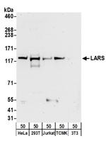 LARS Antibody in Western Blot (WB)