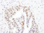 NMNAT1 Polyclonal Antibody