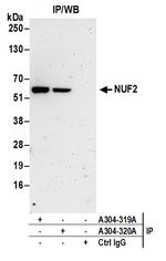 NUF2 Polyclonal Antibody
