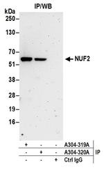 NUF2 Antibody in Immunoprecipitation (IP)