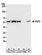 NUF2 Polyclonal Antibody