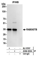 RABGGTB Antibody in Immunoprecipitation (IP)