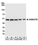 RABGGTB Polyclonal Antibody