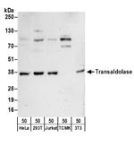 Transaldolase Polyclonal Antibody
