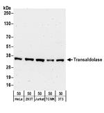 Transaldolase Polyclonal Antibody