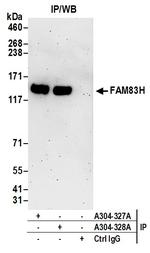 FAM83H Antibody in Immunoprecipitation (IP)