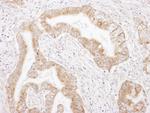 Rictor Antibody in Immunohistochemistry (Paraffin) (IHC (P))