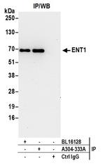 ENT1 Polyclonal Antibody