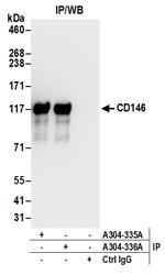 CD146 Antibody in Immunoprecipitation (IP)