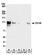 CD146 Antibody in Western Blot (WB)