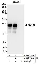 CD146 Antibody in Immunoprecipitation (IP)