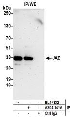 JAZ Antibody in Immunoprecipitation (IP)