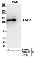 KIF5A Antibody in Immunoprecipitation (IP)