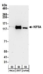 KIF5A Polyclonal Antibody