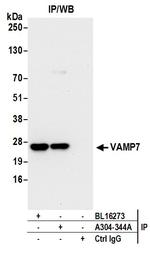 VAMP7 Antibody in Immunoprecipitation (IP)